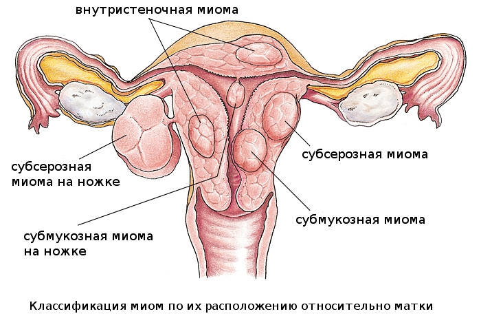 Может ли быть беременность в шейке матки Может ли быть беременность в шейке матки