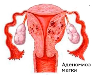 Что это такое