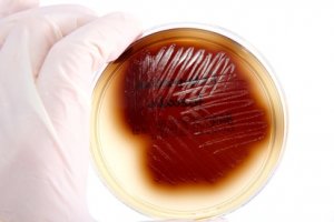 Какие препараты применяют для лечения Enterococcus Faecalis (фекального энтерококка) у женщин