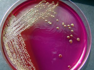 Симптомы Enterococcus Faecalis (фекального энтерококка) в мазке у женщин