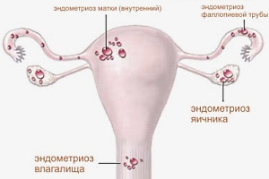 Виды и степени